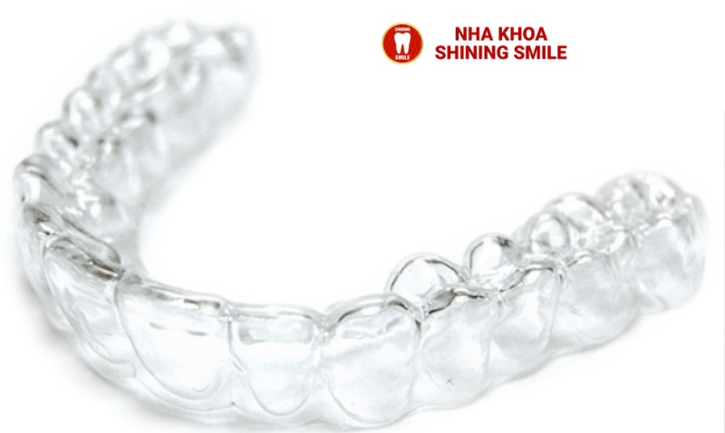 Niềng Răng Cho Trẻ 8 Tuổi: Lợi Ích và Lưu Ý