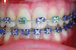 Thông tin từ A-Z hàm duy trì trong suốt