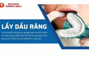 Lấy Dấu Răng Bao Nhiêu Tiền? Bảng Giá Chi Tiết!