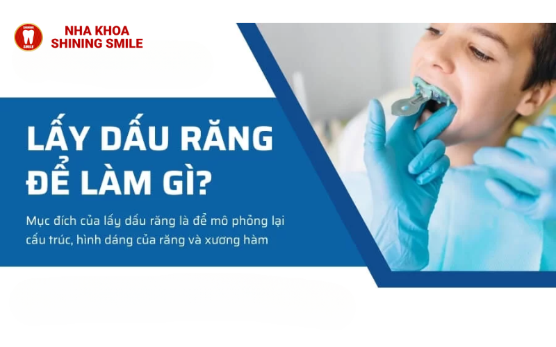 Có thể niềng răng mỗi hàm trên không?
