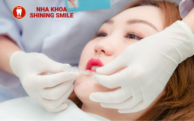 Niềng Răng và MRI: Có Thể Kết Hợp Chúng Không?