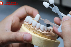 Răng Sứ Lava: Ưu Điểm Vượt Trội Và Chi Phí Thực Hiện
