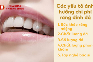 Răng đính đá bao nhiêu tiền là hợp lý? Bảng giá mới nhất hiện nay