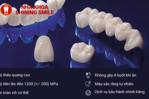 Răng Sứ Đức: Sự Kết Hợp Hoàn Hảo Giữa Thẩm Mỹ Và Chất Lượng