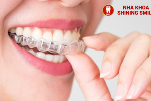So Sánh Niềng Răng Zenyum và Invisalign: Điểm Mạnh Và Điểm Yếu